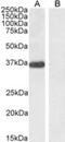 Pancreas Associated Transcription Factor 1a antibody, NB100-60953, Novus Biologicals, Western Blot image 