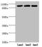 Pitrilysin Metallopeptidase 1 antibody, LS-C676264, Lifespan Biosciences, Western Blot image 