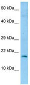 Gastrokine 2 antibody, TA337724, Origene, Western Blot image 