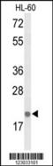 Interleukin 26 antibody, 63-962, ProSci, Western Blot image 