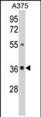 UDP-Galactose-4-Epimerase antibody, PA5-72490, Invitrogen Antibodies, Western Blot image 