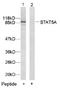 Signal Transducer And Activator Of Transcription 5A antibody, AP02589PU-S, Origene, Western Blot image 