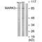 Microtubule Affinity Regulating Kinase 3 antibody, A05355, Boster Biological Technology, Western Blot image 