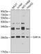 Secretion Associated Ras Related GTPase 1A antibody, 22-968, ProSci, Western Blot image 