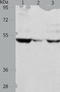 Matrix Metallopeptidase 1 antibody, TA323955, Origene, Western Blot image 