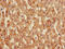 Angiopoietin Like 3 antibody, LS-C394516, Lifespan Biosciences, Immunohistochemistry paraffin image 