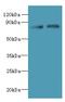 Actin Related Protein 8 antibody, A57990-100, Epigentek, Western Blot image 