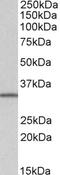 SLC9A3 Regulator 2 antibody, EB06970, Everest Biotech, Western Blot image 