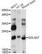 Golgin A7 antibody, LS-C749869, Lifespan Biosciences, Western Blot image 