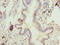 Chitinase Acidic antibody, LS-C675523, Lifespan Biosciences, Immunohistochemistry paraffin image 