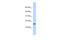 Putative uncharacterized protein encoded by NCRNA00114 antibody, 26-074, ProSci, Western Blot image 