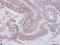 LYN Proto-Oncogene, Src Family Tyrosine Kinase antibody, PA5-27361, Invitrogen Antibodies, Immunohistochemistry paraffin image 