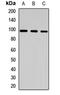 Chloride Voltage-Gated Channel 2 antibody, LS-C667739, Lifespan Biosciences, Western Blot image 