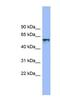 Interleukin 18 Receptor 1 antibody, NBP1-59720, Novus Biologicals, Western Blot image 