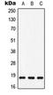 MYC Associated Factor X antibody, LS-C353745, Lifespan Biosciences, Western Blot image 
