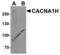Calcium Voltage-Gated Channel Subunit Alpha1 H antibody, 8029, ProSci, Western Blot image 