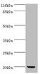 Peptide deformylase antibody, A57013-100, Epigentek, Western Blot image 