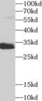 Sulfotransferase Family 1A Member 1 antibody, FNab08376, FineTest, Western Blot image 