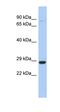 Chromosome 21 Open Reading Frame 91 antibody, orb325233, Biorbyt, Western Blot image 