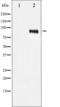 Insulin Like Growth Factor 1 Receptor antibody, GTX52315, GeneTex, Western Blot image 