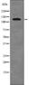 RB Transcriptional Corepressor Like 2 antibody, abx218221, Abbexa, Western Blot image 