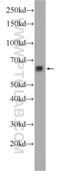 Acyl-CoA Synthetase Medium Chain Family Member 2A antibody, 22862-1-AP, Proteintech Group, Western Blot image 