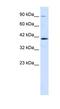 Zinc Finger Protein 830 antibody, MBS833307, MyBioSource, Western Blot image 