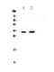 Gap Junction Protein Beta 1 antibody, A01050, Boster Biological Technology, Western Blot image 