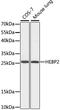 Heme Binding Protein 2 antibody, A09978, Boster Biological Technology, Western Blot image 