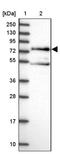 Amyloid Beta Precursor Protein Binding Family A Member 3 antibody, PA5-61037, Invitrogen Antibodies, Western Blot image 