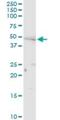 Patatin Like Phospholipase Domain Containing 3 antibody, H00080339-D01P, Novus Biologicals, Western Blot image 