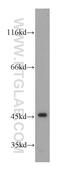 Nuclear Receptor Subfamily 1 Group I Member 3 antibody, 21042-1-AP, Proteintech Group, Western Blot image 