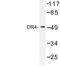 TNF Receptor Superfamily Member 10a antibody, LS-C176885, Lifespan Biosciences, Western Blot image 