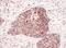 p33 antibody, A302-861A, Bethyl Labs, Immunohistochemistry paraffin image 