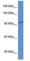 Zinc Finger CCCH-Type Containing 3 antibody, NBP1-74066, Novus Biologicals, Western Blot image 