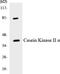Casein Kinase 2 Alpha 1 antibody, LS-C286280, Lifespan Biosciences, Western Blot image 