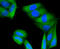 Protein Kinase C Alpha antibody, 13-914, ProSci, Immunofluorescence image 