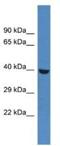 Phosphorylase Kinase Catalytic Subunit Gamma 1 antibody, NBP1-79637, Novus Biologicals, Western Blot image 