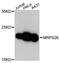Mitochondrial Ribosomal Protein S26 antibody, A14744, Boster Biological Technology, Western Blot image 
