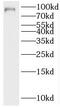 MALT1 Paracaspase antibody, FNab04958, FineTest, Western Blot image 