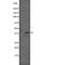 Musashi RNA Binding Protein 1 antibody, abx216951, Abbexa, Western Blot image 