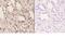 Tumor Susceptibility 101 antibody, A01233, Boster Biological Technology, Immunohistochemistry paraffin image 