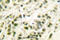 DNA Polymerase Beta antibody, A01946, Boster Biological Technology, Immunohistochemistry paraffin image 