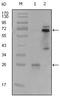 Spleen Associated Tyrosine Kinase antibody, GTX83029, GeneTex, Western Blot image 