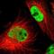 KH Domain Containing 4, Pre-MRNA Splicing Factor antibody, NBP1-86485, Novus Biologicals, Immunocytochemistry image 