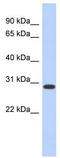 Homeobox D12 antibody, TA329719, Origene, Western Blot image 