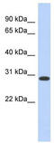 Homeobox D12 antibody, TA329719, Origene, Western Blot image 