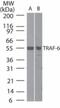 TNF Receptor Associated Factor 6 antibody, NB100-56436, Novus Biologicals, Western Blot image 