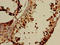 ELOVL Fatty Acid Elongase 4 antibody, orb52130, Biorbyt, Immunohistochemistry paraffin image 