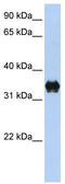 Pyrroline-5-Carboxylate Reductase 2 antibody, TA334475, Origene, Western Blot image 